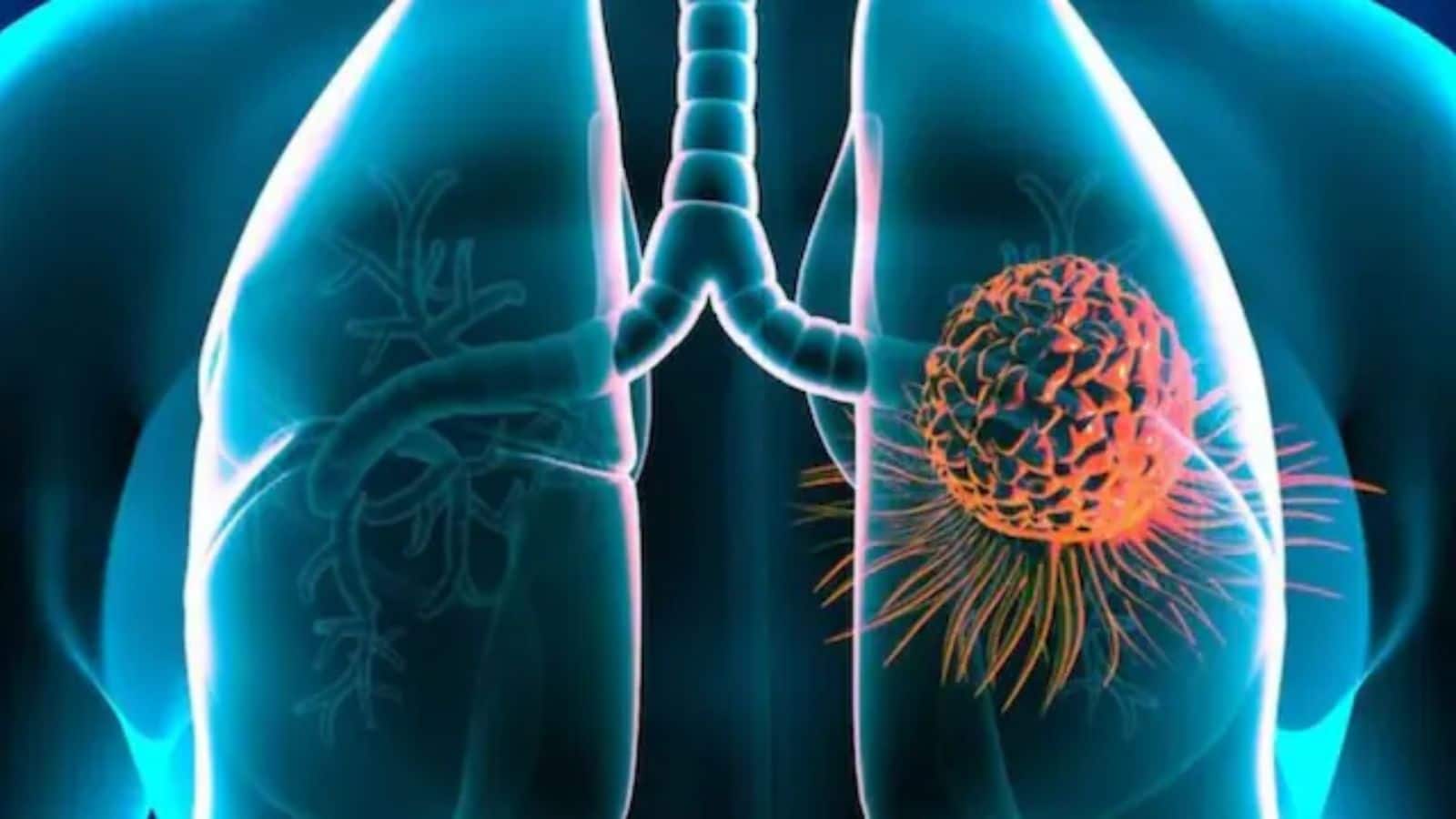 अमेरिका में फैल रहा जानलेवा फंगस एस्परगिलस फ्यूमिगेटस, हवा में फैलता है और शरीर को अंदर से कर देता है खोखला!