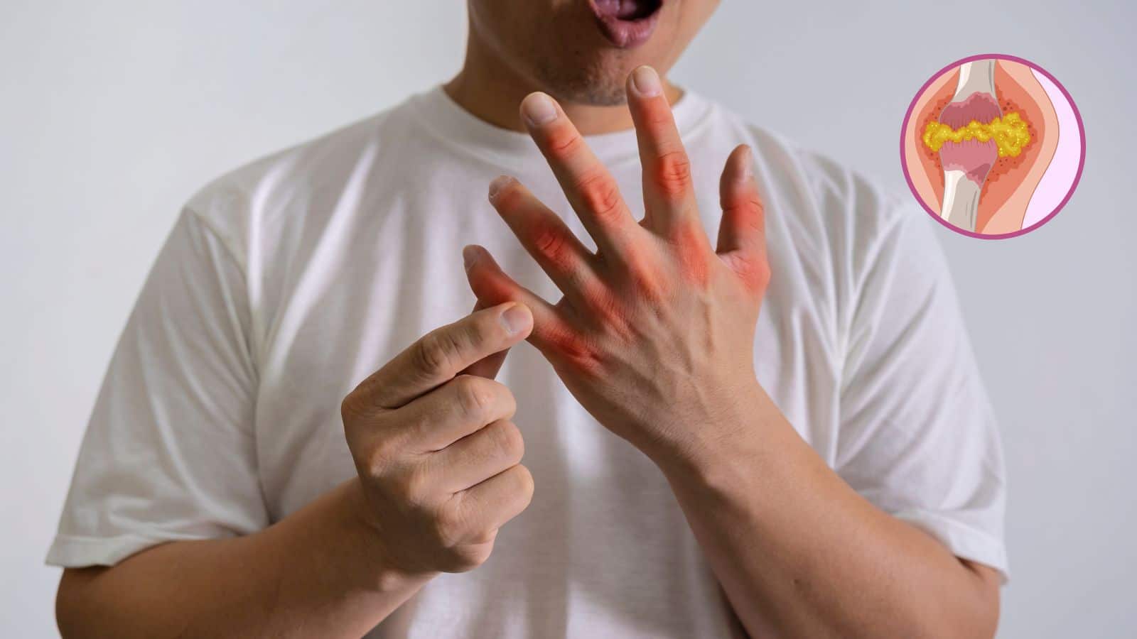 Uric Acid: अब नहीं झेलना पड़ेगा जोड़ों का दर्द, ये सस्ती चीज करेगी यूरिक एसिड का सफाया!