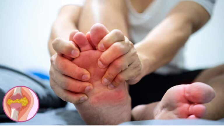 Uric Acid: गठिया और पथरी का काल है ये घरेलू उपाय, यूरिक एसिड को करेगा छूमंतर