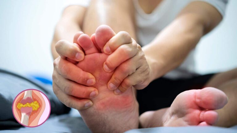 Uric Acid: बढ़ गया है आपका यूरिक एसिड? इन दालों से आज ही करें तौबा, यहां जानें सब कुछ