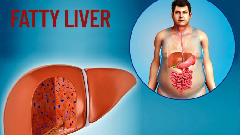 Fatty Liver: लिवर सिरोसिस का डर खत्म! इस देसी नुस्खे से लिवर होगा टनाटन, पेट भी रहेगा साफ