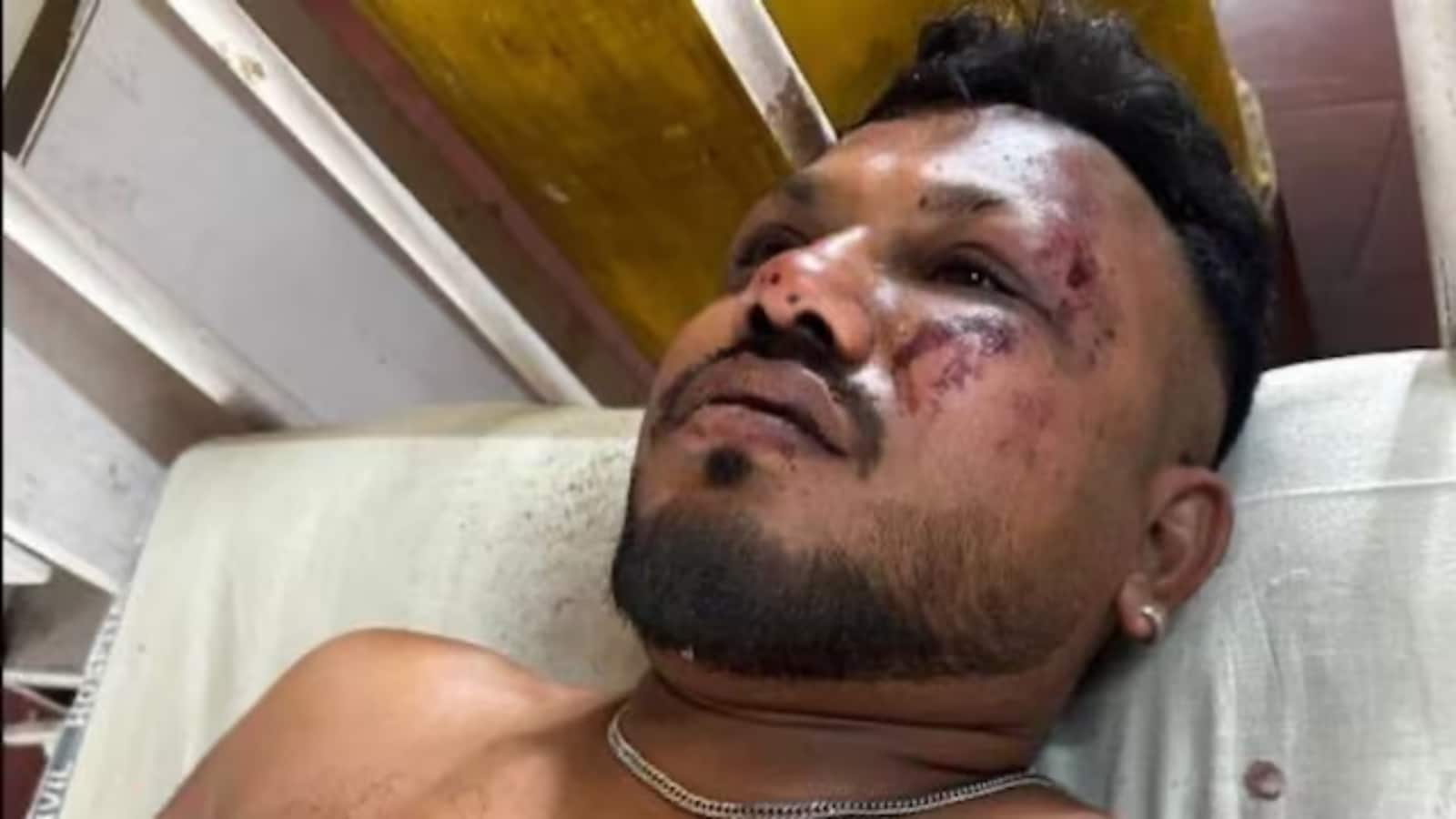 Ahmedabad Plane Crash: आग का गोला बने प्लेन से जिंदा बच निकला एक शख्स, कैसे हुआ ये करिश्मा?