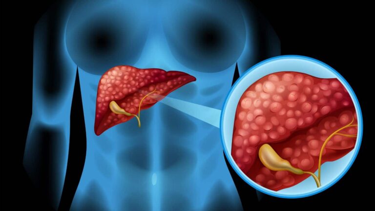Liver: कहीं आप भी तो नहीं कर रहे हैं ये गलतियां? लिवर के लिए हो सकती है खतरनाक
