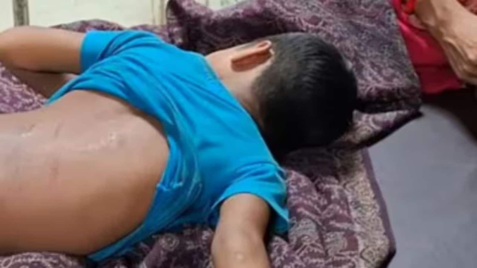 5 साल की मासूम को बेल्ट से पीटा, सुइयां चुभोई! बिहार में प्राइवेट स्कूल के प्रिंसिपल का भतीजा बना जल्लाद