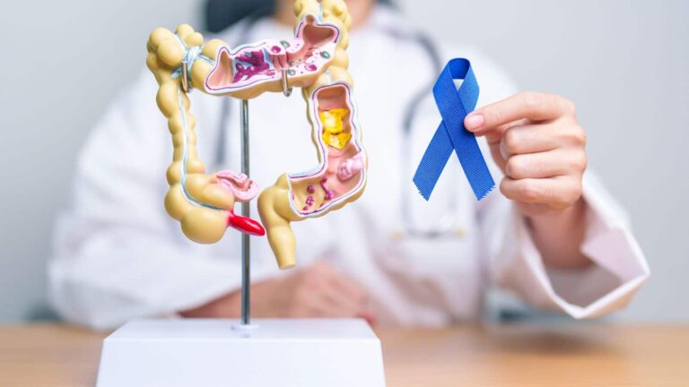 Colon Cancer: कम उम्र में भी हो सकता है कोलन कैंसर, इन 6 लक्षणों को न करें इग्नोर