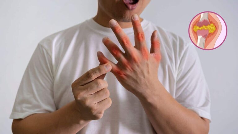 Uric Acid: 24 घंटे का ये बदलाव बन सकता है किडनी फेलियर की वजह, यूरिक एसिड धीरे-धीरे कर देता है पूरा सिस्टम फेल!