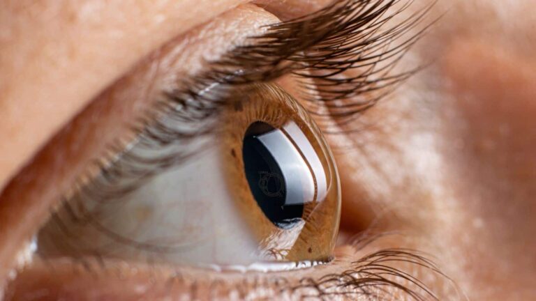 Eye donate:  क्या आप जानते हैं आंख का कौन-सा हिस्सा नेत्रदान में सबसे जरूरी होता है?