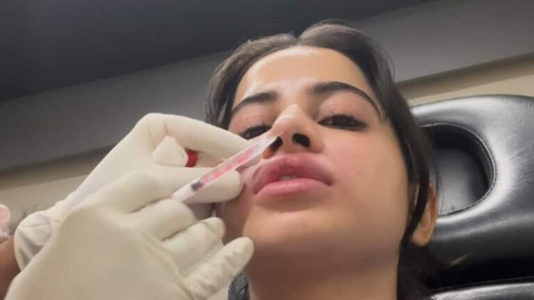 लिप फिलर्स हटवाकर बिगड़ा उर्फी जावेद के चेहरे का हाल, बोल पाना भी हुआ मुश्किल , जल्द पहुंची क्लीनीक