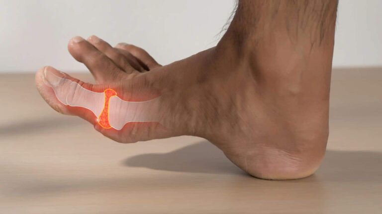 Uric Acid: यूरिक एसिड बना रहा है शरीर में 'कचरे' का ढेर, इन 5 देसी जुगाड़ से होगा पूरा सफाया