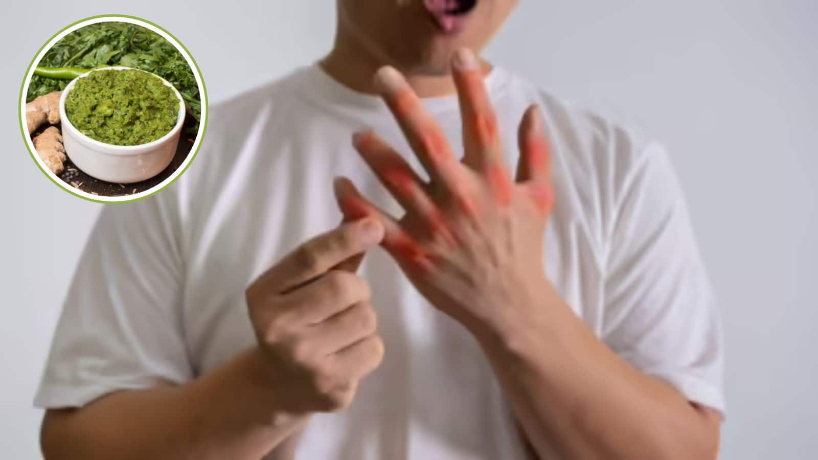 Uric Acid: जोड़ों का दर्द छूमंतर! यूरिक एसिड घटाएगी ये हरी चटनी, जानिए कैसे