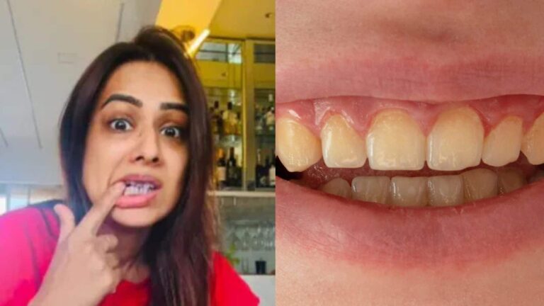 Nia Sharma ने बताया झटपट टीथ व्हाइटनिंग तरीका, जानें डॉक्टर की राय