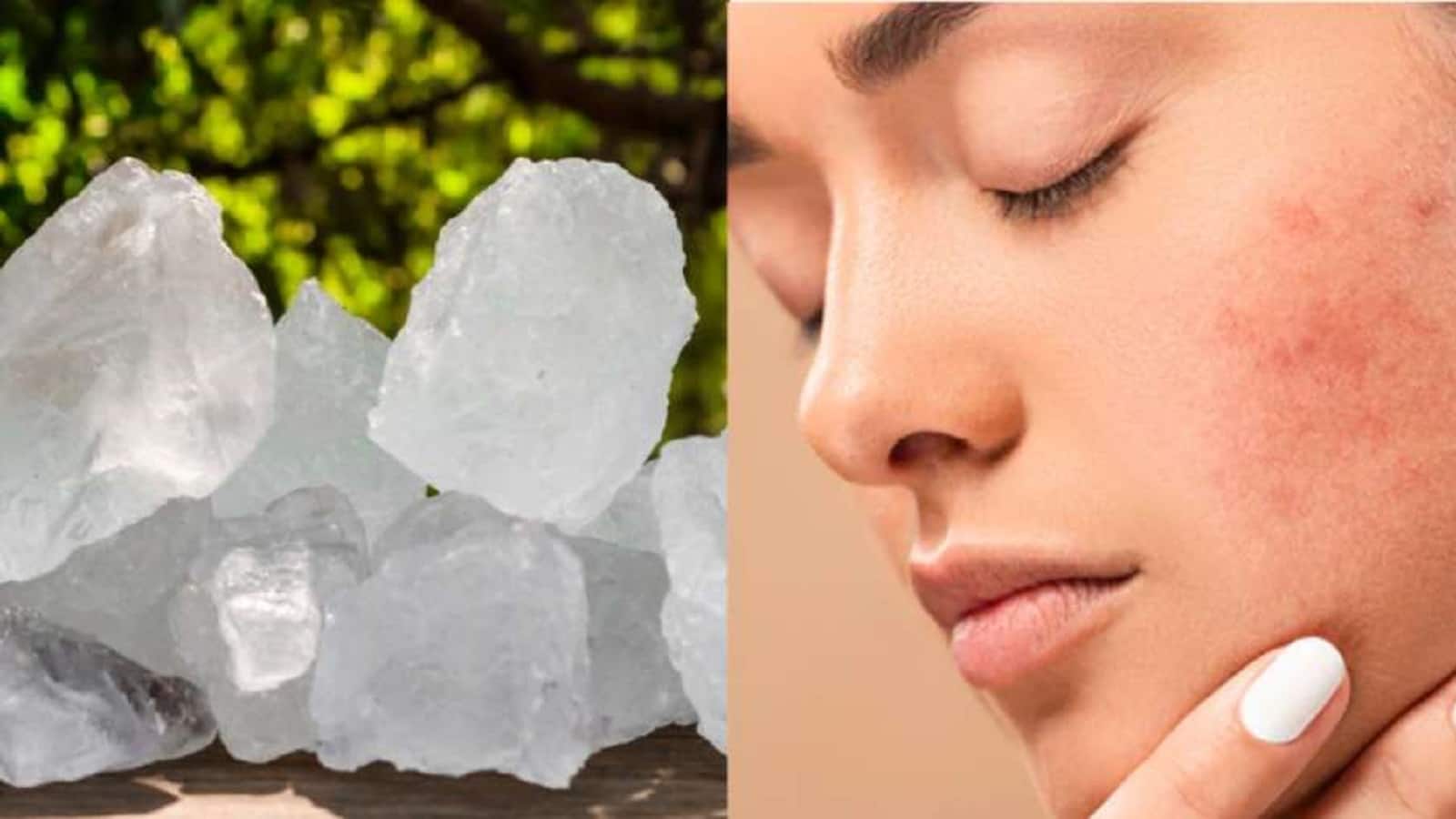 Skin care Tips: सस्ती सी फिटकरी के फायदे महंगे ट्रीटमेंट से बहुत ज्यादा, इन दिक्कतों को करती है दूर