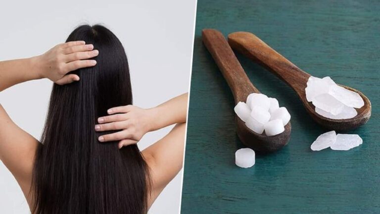 Dandruff home remedies: डैंड्रफ से निजात दिलाने में कारगर हैं हर घर में मौजूद ये तीन चीजें, आप भी जानिए