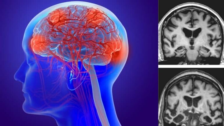 सावधान! दिमाग को चुपचाप खोखला कर रहा है ये खतरा, जब तक समझ आए, बहुत देर हो चुकी होती है