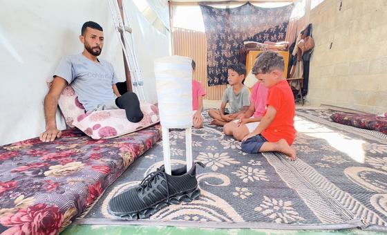 ग़ाज़ा: भोजन की तलाश में अंग गँवाने वाले घायलों की दास्ताँ