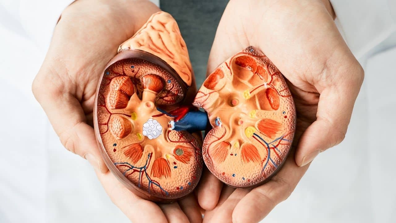 किडनी स्टोन में बीयर पीना सही या गलत? जानिए सच्चाई और घरेलू उपाय