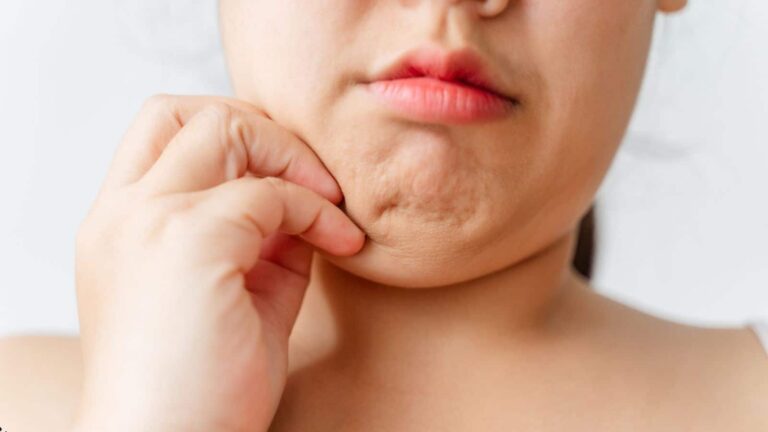 काफी कोशिश के बाद भी नहीं कम हो रहा आपका डबल चिन? इन आसान तरीकों से दिखेगा फर्क