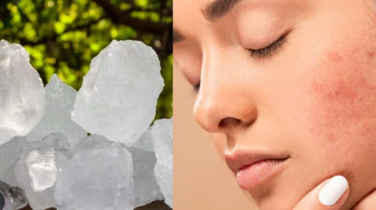 Skin Care Tips: यह सफेद पत्थर चेहरे की समस्या जैसे मुंहासे, पिंपल्स और डार्क स्पॉट्स को चुटकी में करेगा गायब, जानिए इस रामबाण का नाम