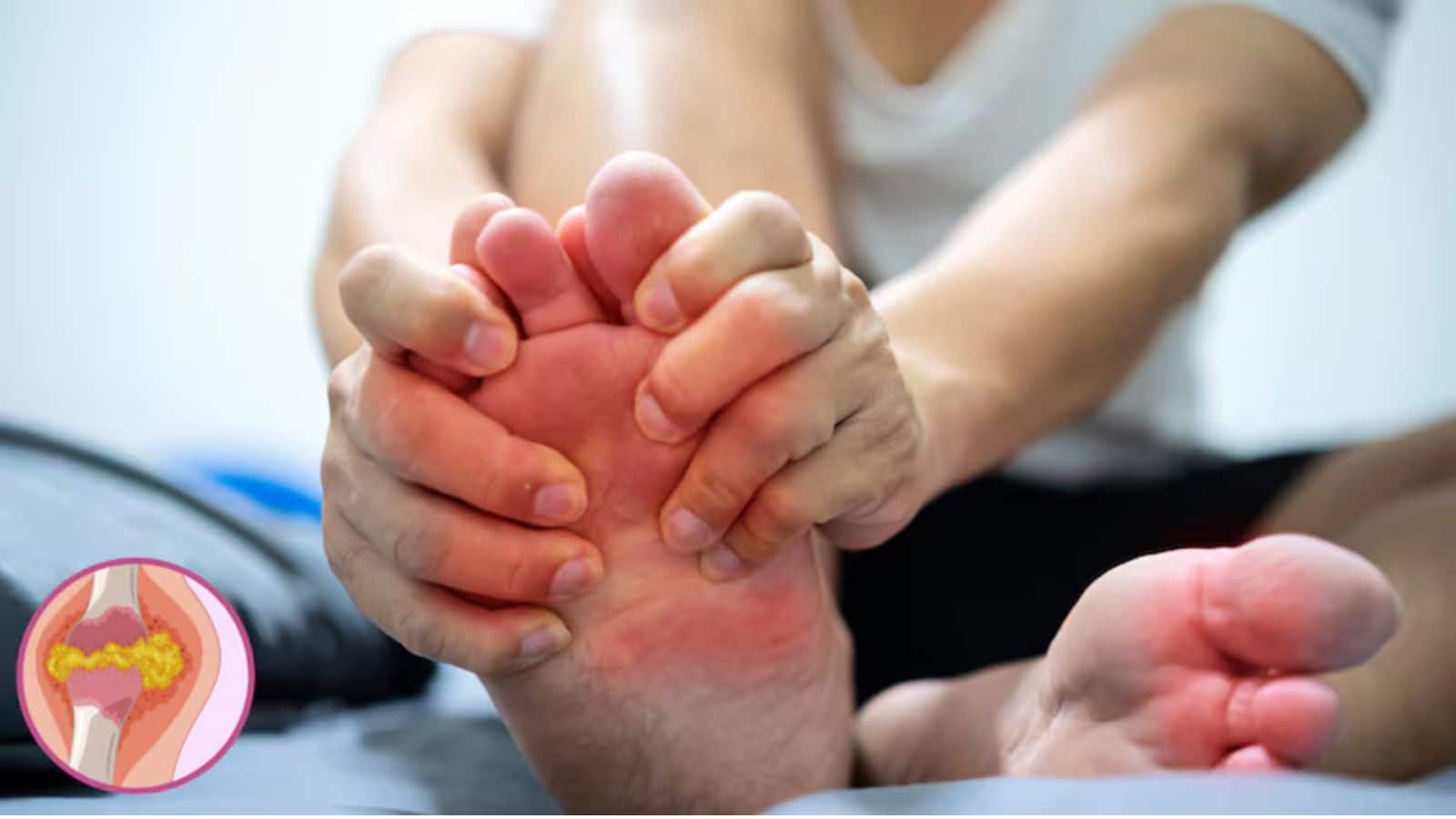 Uric Acid: यूरिक एसिड बढ़ने के 6 छिपे लक्षण, जो नजरअंदाज करना महंगा पड़ सकता है