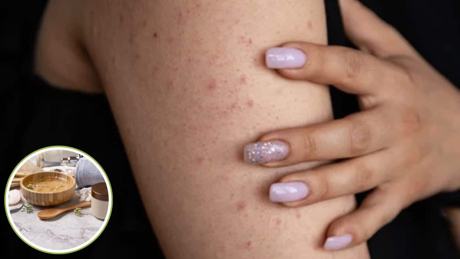 बाजू-पैरों पर दानों की भरमार? कॉफी वाला ये नुस्खा देगा ग्लास जैसी स्किन!