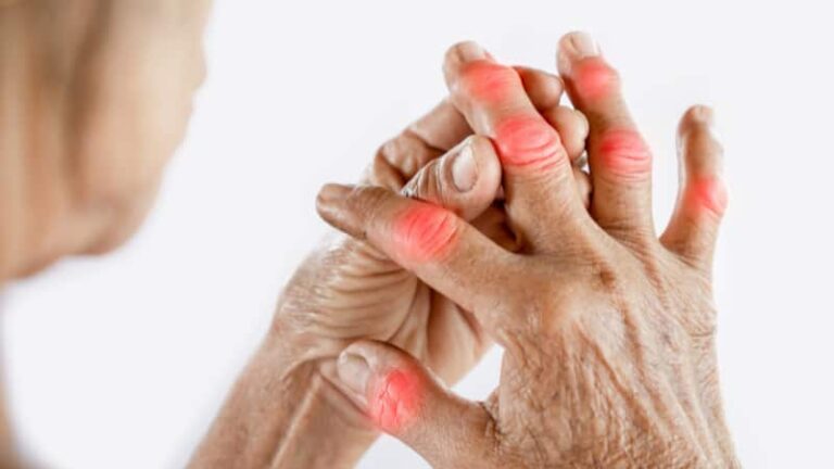 Health Tips: इतने खतरनाक हो सकते हैं गठिया के शुरुआती लक्षण, इन्हें न करें अनदेखा