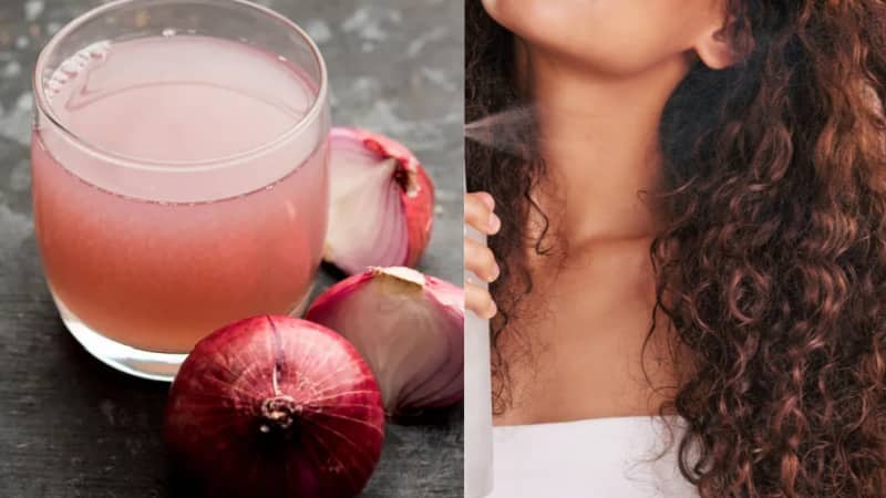 Hair Care: प्याज का रस बालों के लिए है वरदान, नए बाल उगाने के तीन असरदार घरेलू नुस्खे
