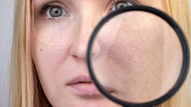 साफ और ग्लोइंग स्किन चाहिए? ये ओपन पोर्स के उपाय जरूर आजमाएं, फिर देंखे रिजल्ट