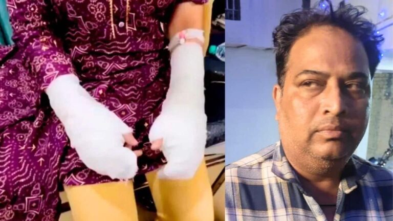 Delhi Acid Attack Case: घर से टॉयलेट क्लीनर ले गई और खुद अपने…एसिड अटैक की पलट गई कहानी