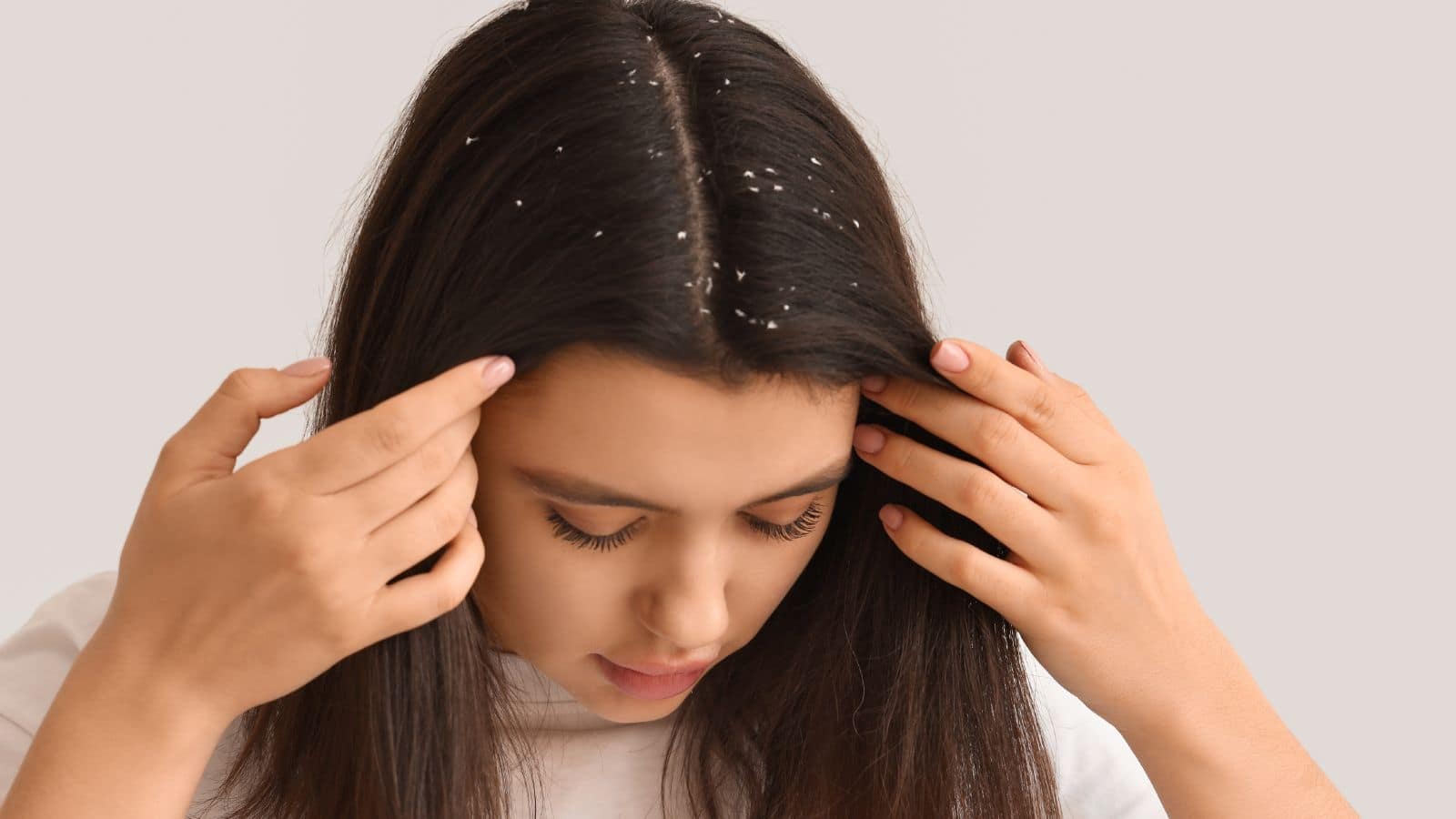Hair Care Tips for Dandruff: सिर्फ 30 मिनट में डैंड्रफ से छुटकारा! जानें दही-मेथी-एलोवेरा का नुस्खा