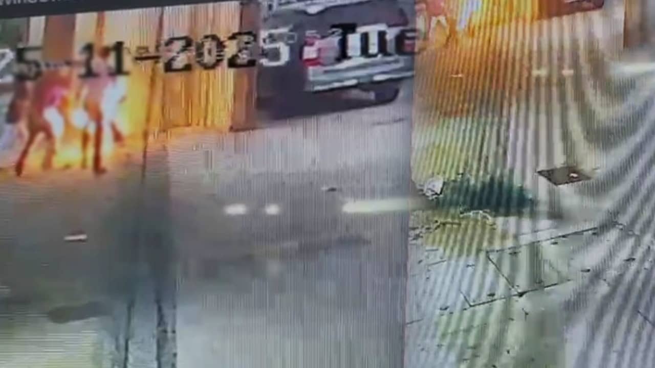 Mumbai: जन्मदिन पर केक काटने के बहाने दोस्तों ने घर से बुलाया, फिर पेट्रोल छिड़क जिंदा जलाया; बर्थडे बॉय की हालत गंभीर