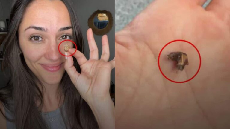 अधखुली नाक से सांस लेती थी महिला, 35 साल बाद सामने आया चौंकाने वाला सच!