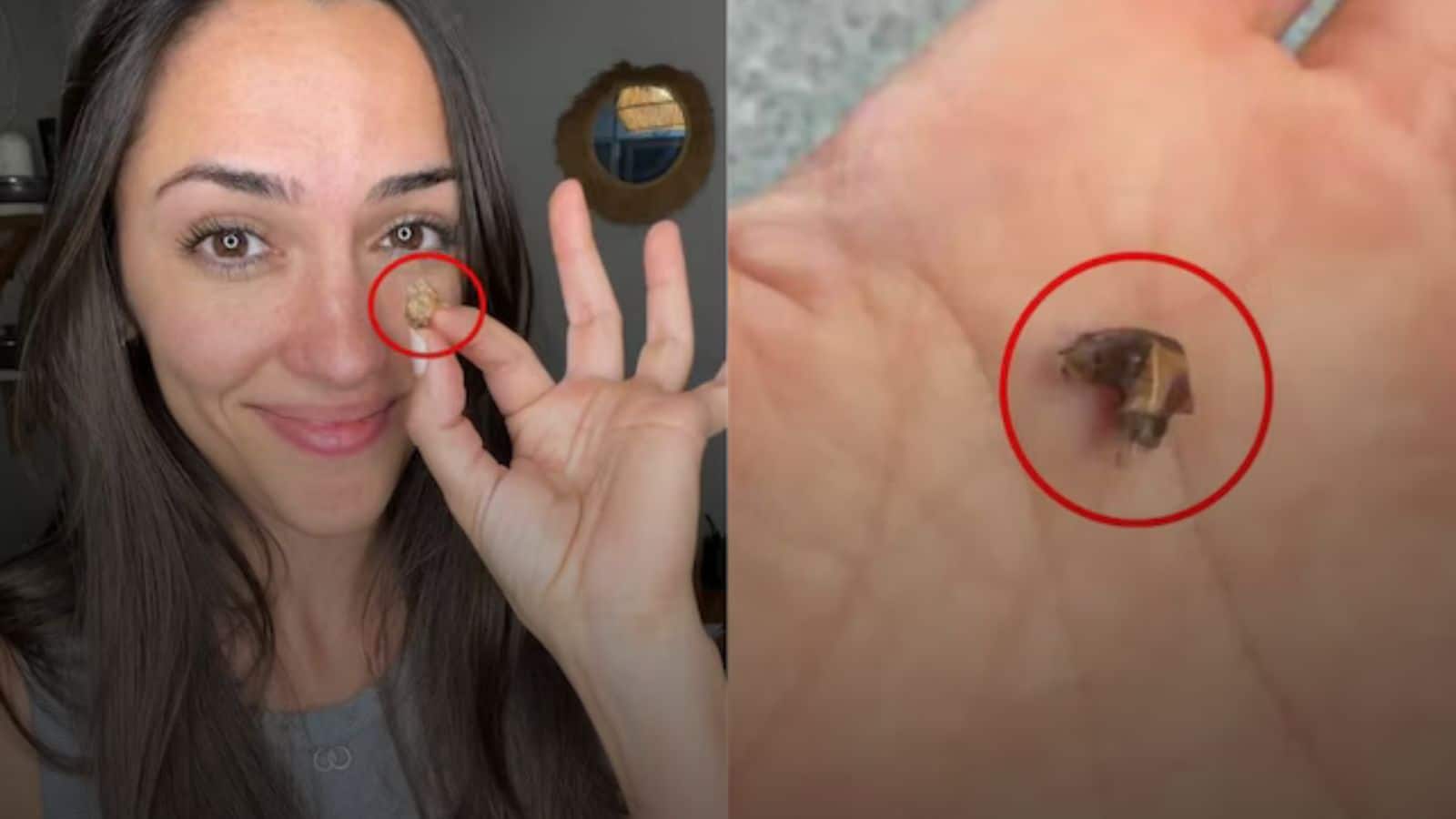 अधखुली नाक से सांस लेती थी महिला, 35 साल बाद सामने आया चौंकाने वाला सच!