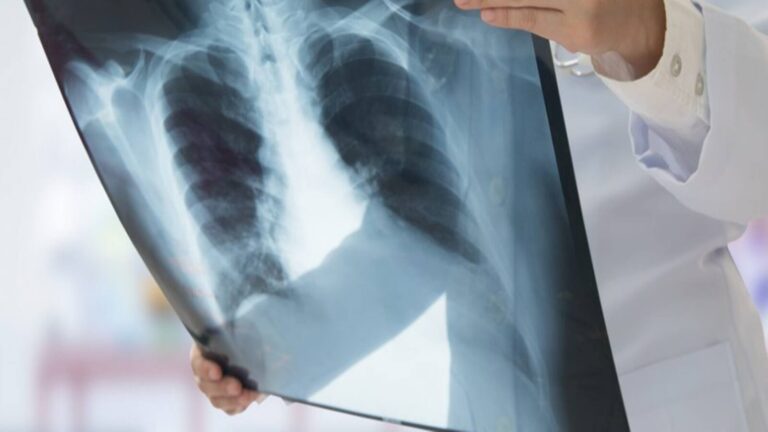 Invicta Diagnostic IPO Listing: लिस्ट होते ही लोअर सर्किट, 17% प्रीमियम पर एंट्री के बाद ₹85 के शेयरों को लगा शॉक