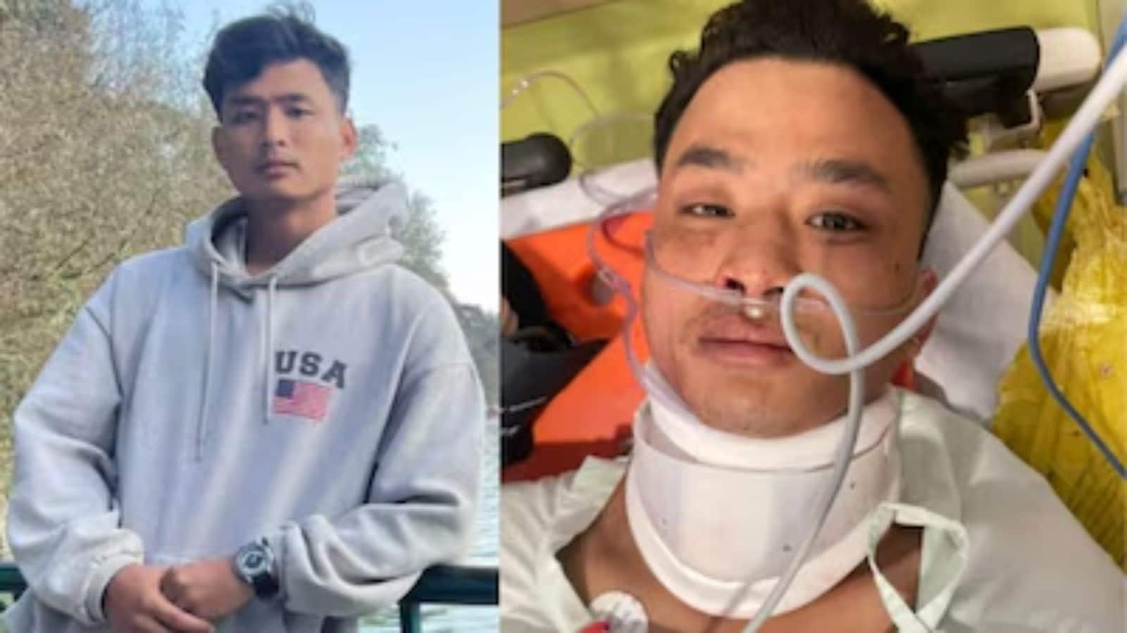 'हम चीनी नहीं, भारतीय हैं...', देहरादून में नस्लीय हमले के बाद त्रिपुरा के MBA छात्र की मौत; पूर्वोत्तर में भारी आक्रोश