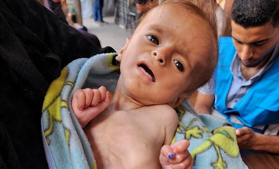 ग़ाज़ा: नवजात शिशुओं पर जन्म के साथ ही, युद्ध के विनाश का जानलेवा साया