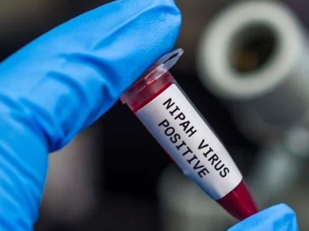 Nipah Virus: पश्चिम बंगाल में निपाह वायरस की एंट्री! मिले दो मामले, केंद्र ने भेजी एक्सपर्ट्स की टीम