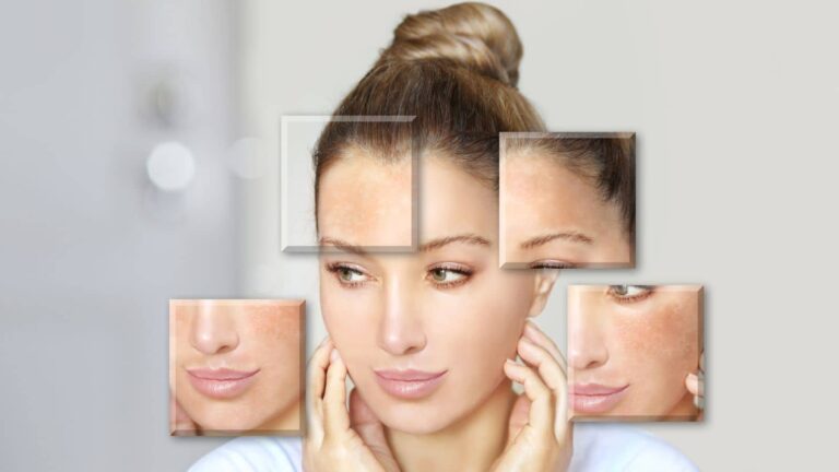 Winter skin care tips: सर्दियों में चेहरा हो गया है डल? ये 6 घरेलू नुस्खे कर देंगे कमाल