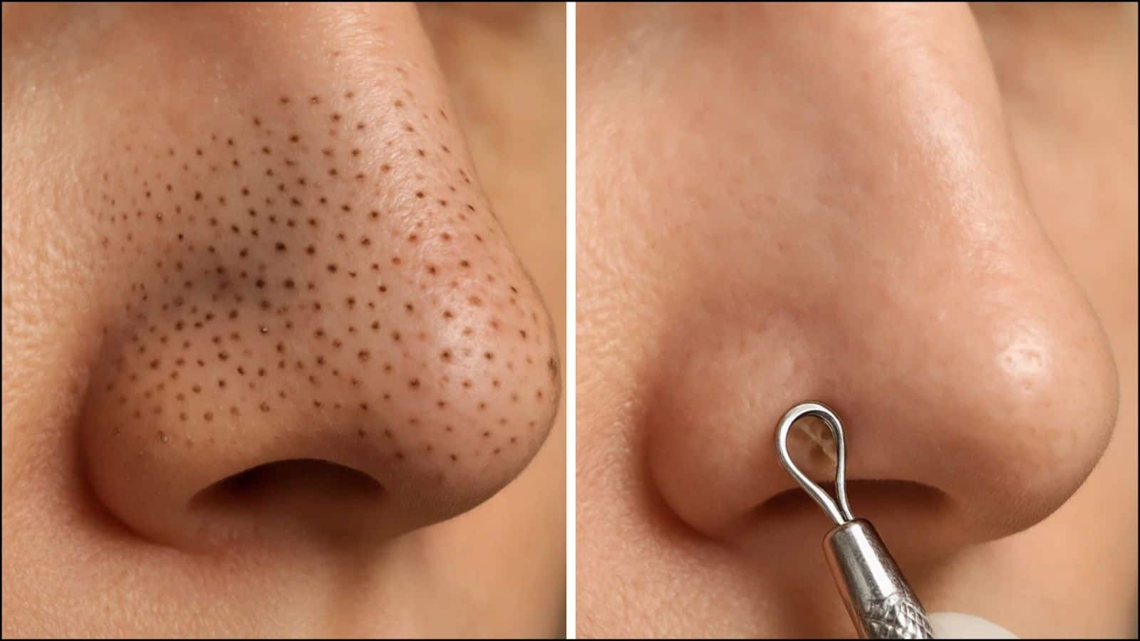 Tip and Tricks: ठंडी हवा और रूखी त्वचा से परेशान? अपनाएं ये आसान टिप्स और पाएं दमकती स्किन