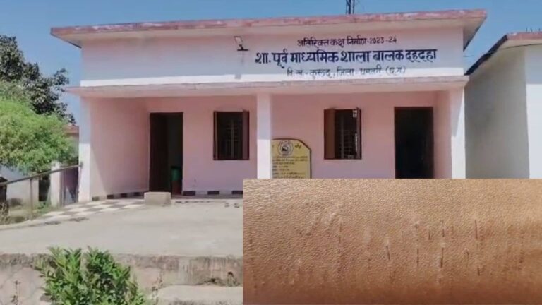 मोबाइल गेम का टास्‍क, खतरनाक ब्‍लेड ट्रेंड या कुछ और...21 छात्र-14 छात्राओं ने काट लिया अपना हाथ; छत्तीसगढ़ में सन्न कर देने वाली वारदात