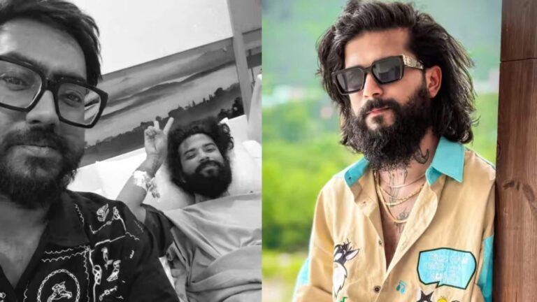 ICU से बाहर आए UK07 Rider,  अनुराग दोभाल की हालत में सुधार, मैनेजर ने शेयर की तस्वीर