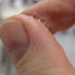 फेवीक्विक चिपक जाए उंगलियों पर तो न करें पैनिक! जानिए आसान हटाने का तरीका