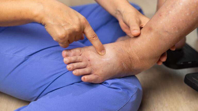 धूप से पड़े सैंडल के निशान हटाना हुआ आसान, इस जूस का करें इस्तेमाल