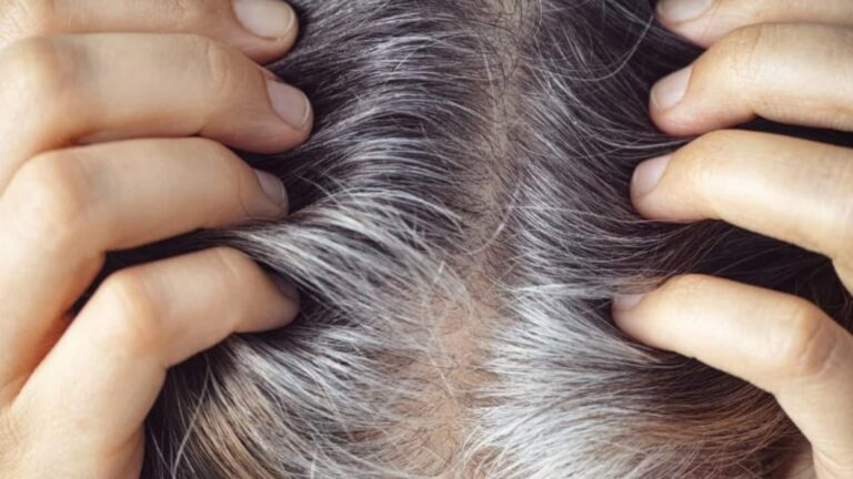 क्या जवानी में ही सफेद हो रहे हैं आपके बाल? आयुर्वेद डॉक्टर ने बताया कि किचन की कौन सी चीजें हैं बालों की दुश्मन