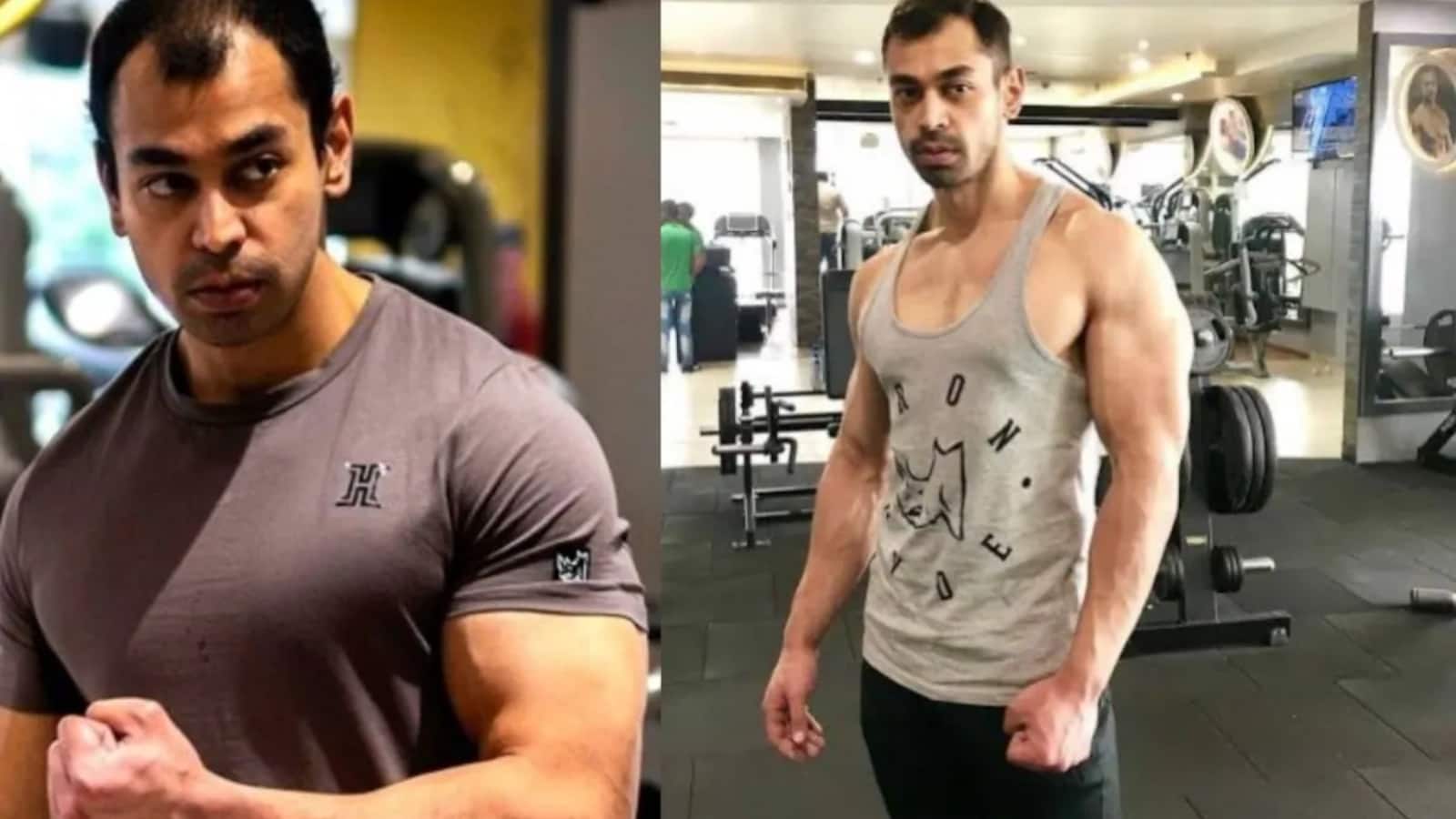 किस हालत में अस्पताल लाए गए थे प्रतीक यादव? सिविल अस्पताल के CMS ने किया चौंकाने वाला खुलासा