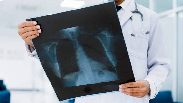 Lung Cancer symptoms: लंग्स कैंसर के इन शुरुआती 5 लक्षणों को पहचानिए, डॉक्टर से जानिए इन्हें नजरअंदाज करना कितना है खतरनाक