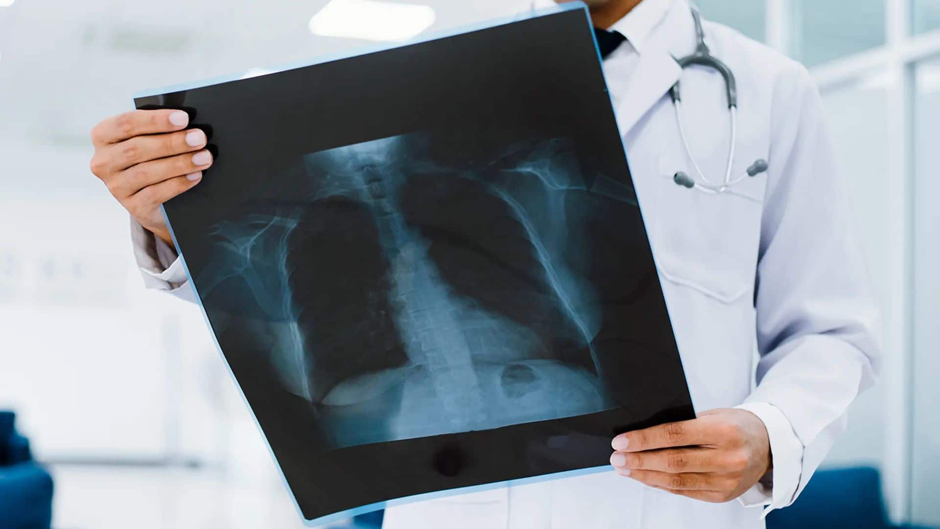 Lung Cancer symptoms: लंग्स कैंसर के इन शुरुआती 5 लक्षणों को पहचानिए, डॉक्टर से जानिए इन्हें नजरअंदाज करना कितना है खतरनाक