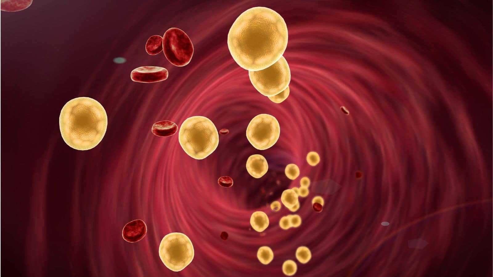 LDL Cholesterol: डॉक्टर ने डाइट और रूटीन में वो 5 चेंज बताए जो LDL कोलेस्ट्रॉल को कर देंगी कम