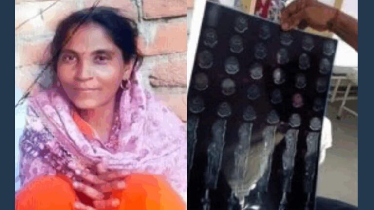 फ्रैक्चर का इलाज कराने पहुंची महिला का डॉक्टर ने कर दिया दिल का ऑपरेशन! हुई मौत, जानें पूरा मामला