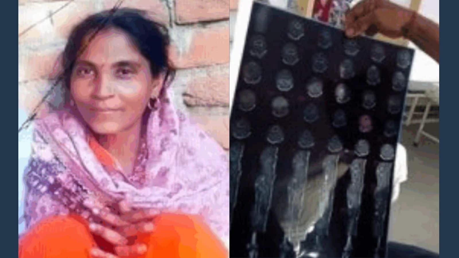 फ्रैक्चर का इलाज कराने पहुंची महिला का डॉक्टर ने कर दिया दिल का ऑपरेशन! हुई मौत, जानें पूरा मामला